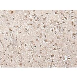 ZFP36 Antibody from Signalway Antibody (43567) - Antibodies.com