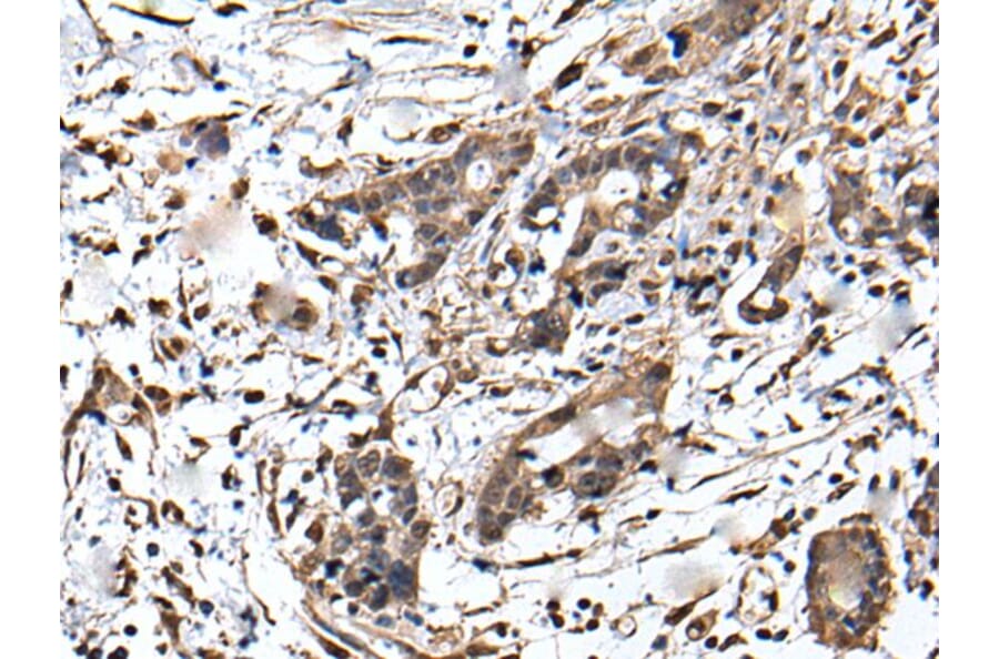 ZFP36 Antibody from Signalway Antibody (43567) - Antibodies.com