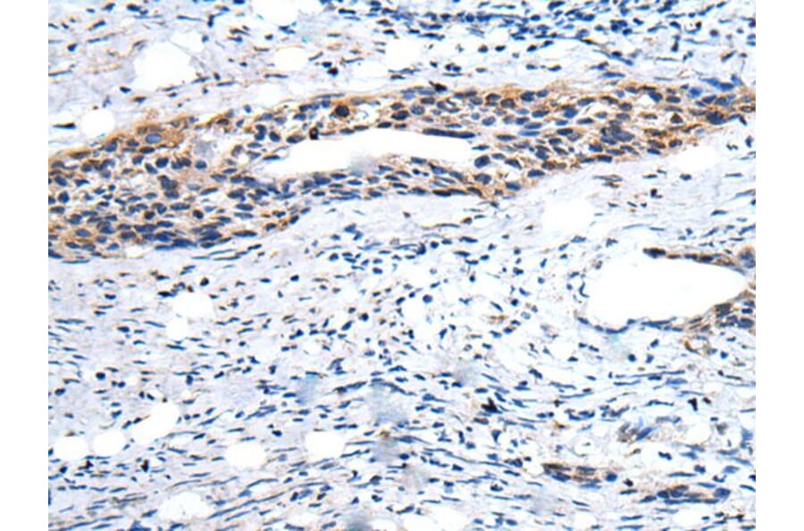 YPEL1 Antibody from Signalway Antibody (43586) - Antibodies.com