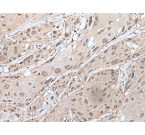 YPEL3 Antibody from Signalway Antibody (43587) - Antibodies.com