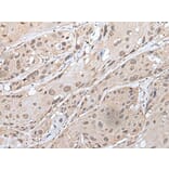 YPEL3 Antibody from Signalway Antibody (43587) - Antibodies.com