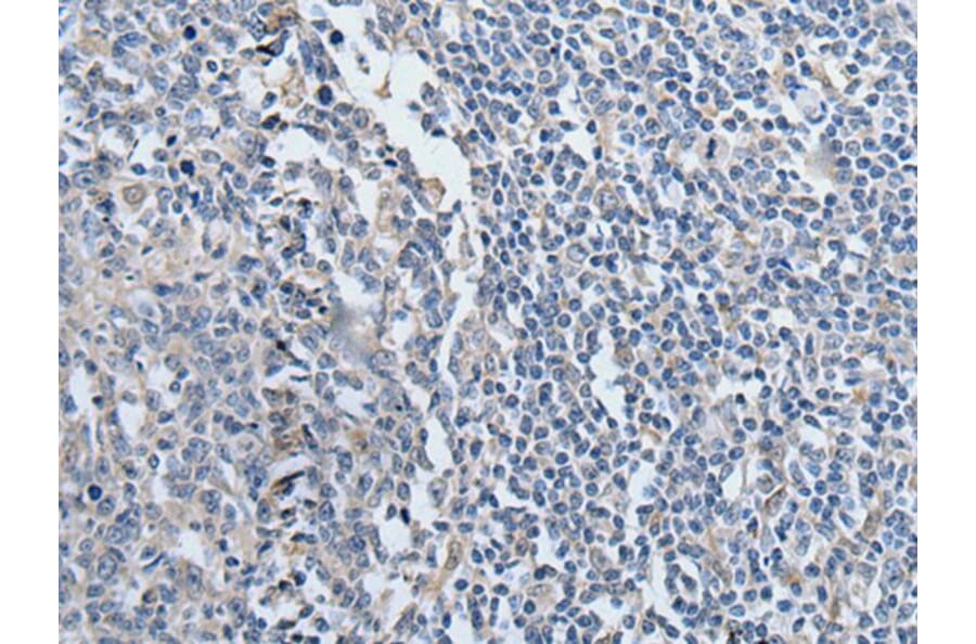 YPEL2 Antibody from Signalway Antibody (43588) - Antibodies.com