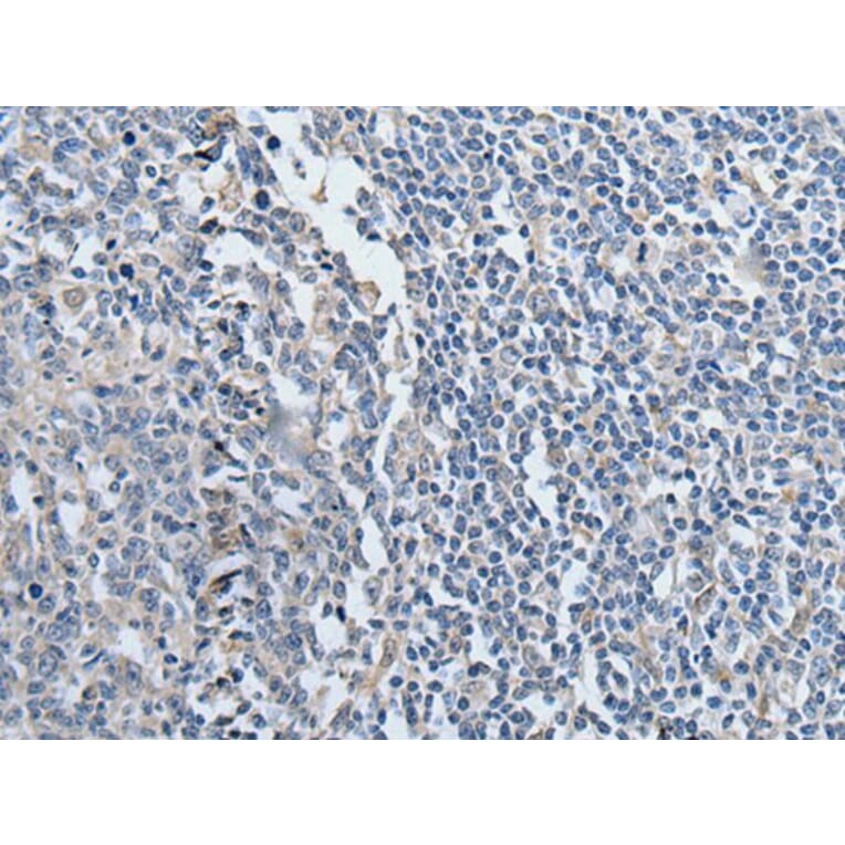 YPEL2 Antibody from Signalway Antibody (43588) - Antibodies.com
