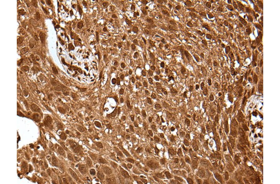 UBE4A Antibody from Signalway Antibody (43609) - Antibodies.com