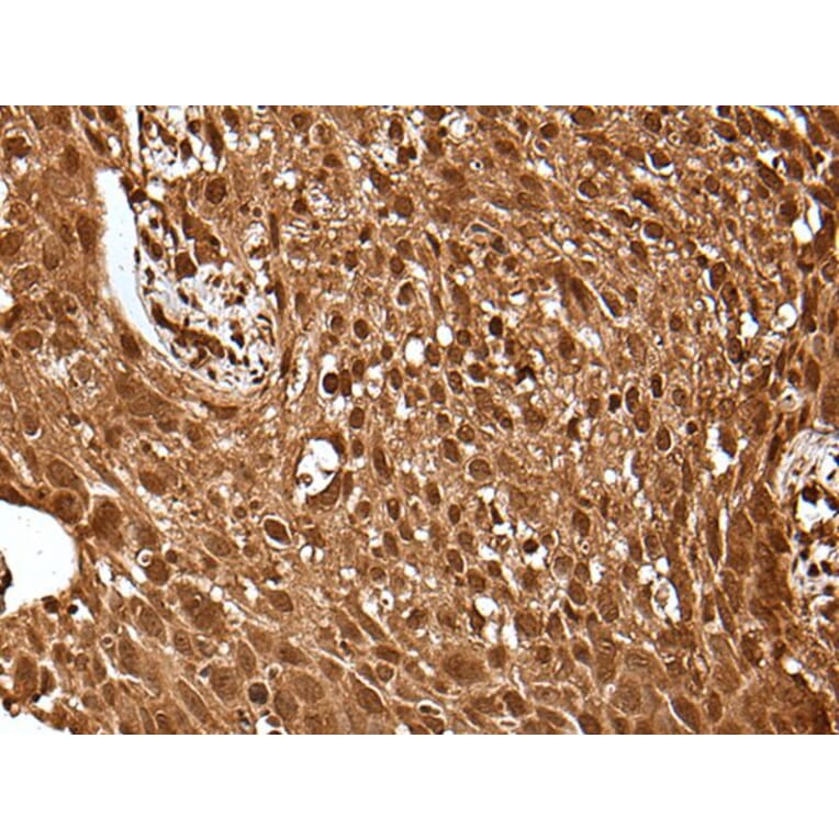 UBE4A Antibody from Signalway Antibody (43609) - Antibodies.com