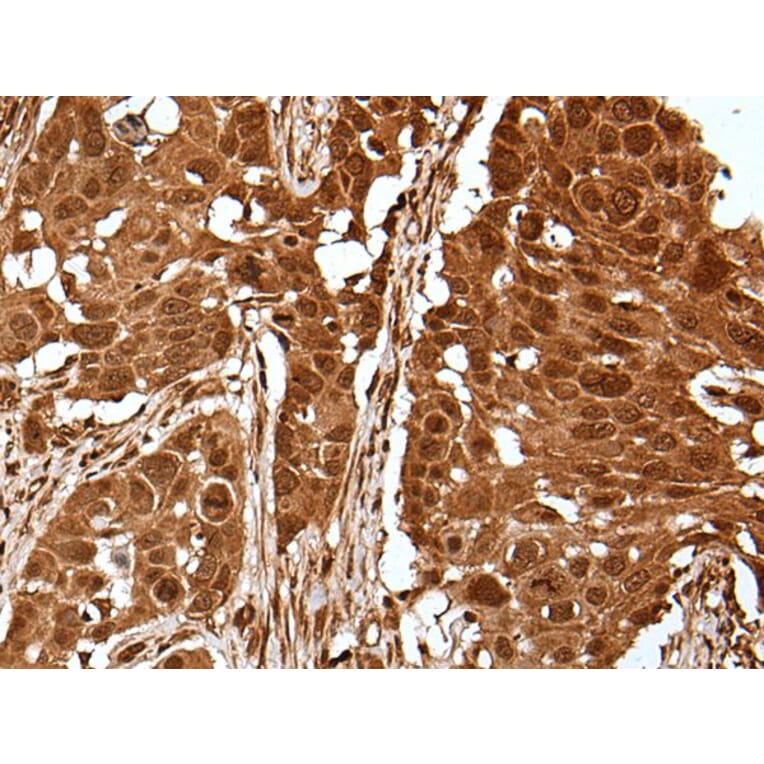 UBE4A Antibody from Signalway Antibody (43609) - Antibodies.com