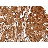 UBE4A Antibody from Signalway Antibody (43609) - Antibodies.com