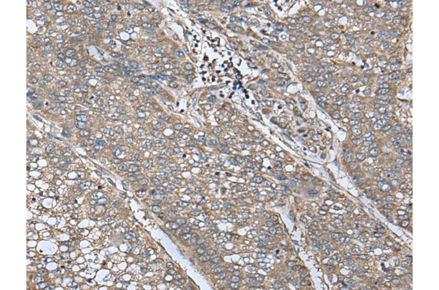 UQCRQ Antibody from Signalway Antibody (43618) - Antibodies.com