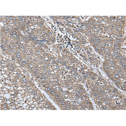 UQCRQ Antibody from Signalway Antibody (43618) - Antibodies.com