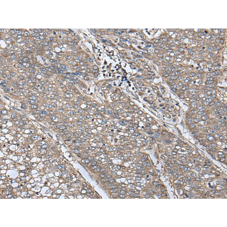 UQCRQ Antibody from Signalway Antibody (43618) - Antibodies.com