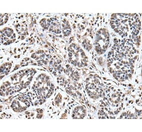 UPK3A Antibody from Signalway Antibody (43619) - Antibodies.com