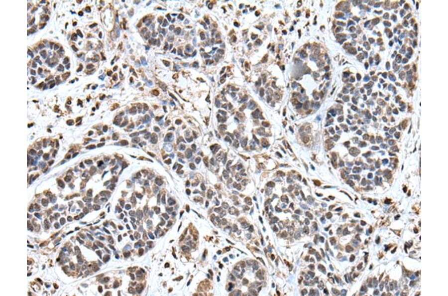 UPK3A Antibody from Signalway Antibody (43619) - Antibodies.com