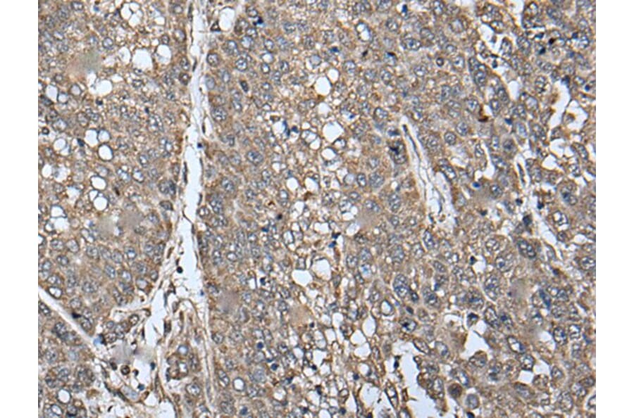 ATAD1 Antibody from Signalway Antibody (43622) - Antibodies.com