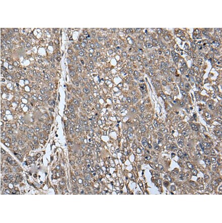 ATAD1 Antibody from Signalway Antibody (43622) - Antibodies.com