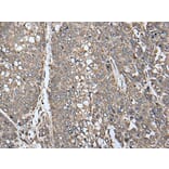 ATAD1 Antibody from Signalway Antibody (43622) - Antibodies.com