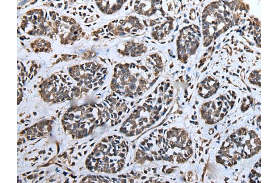ATAD1 Antibody from Signalway Antibody (43622) - Antibodies.com