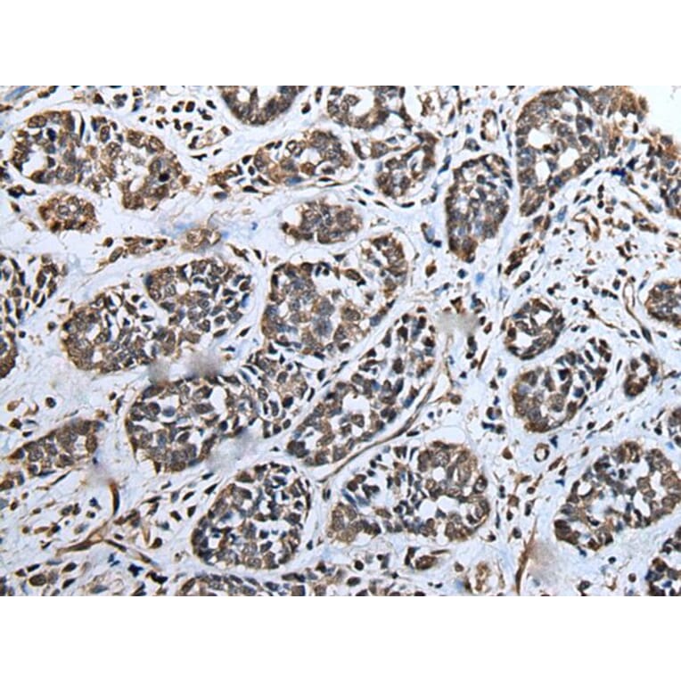 ATAD1 Antibody from Signalway Antibody (43622) - Antibodies.com