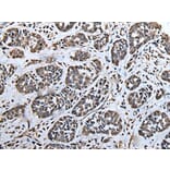 ATAD1 Antibody from Signalway Antibody (43622) - Antibodies.com