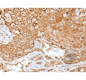 IL6ST Antibody from Signalway Antibody (43623) - Antibodies.com