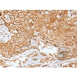 IL6ST Antibody from Signalway Antibody (43623) - Antibodies.com