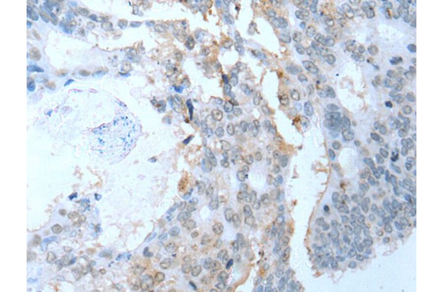 SYCP2 Antibody from Signalway Antibody (43633) - Antibodies.com