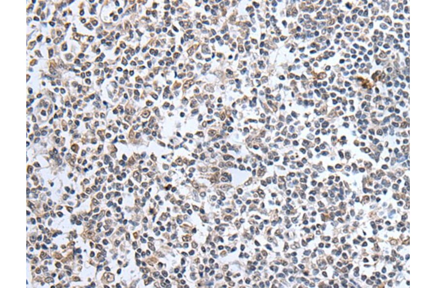 SULF2 Antibody from Signalway Antibody (43638) - Antibodies.com