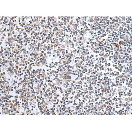 SULF2 Antibody from Signalway Antibody (43638) - Antibodies.com
