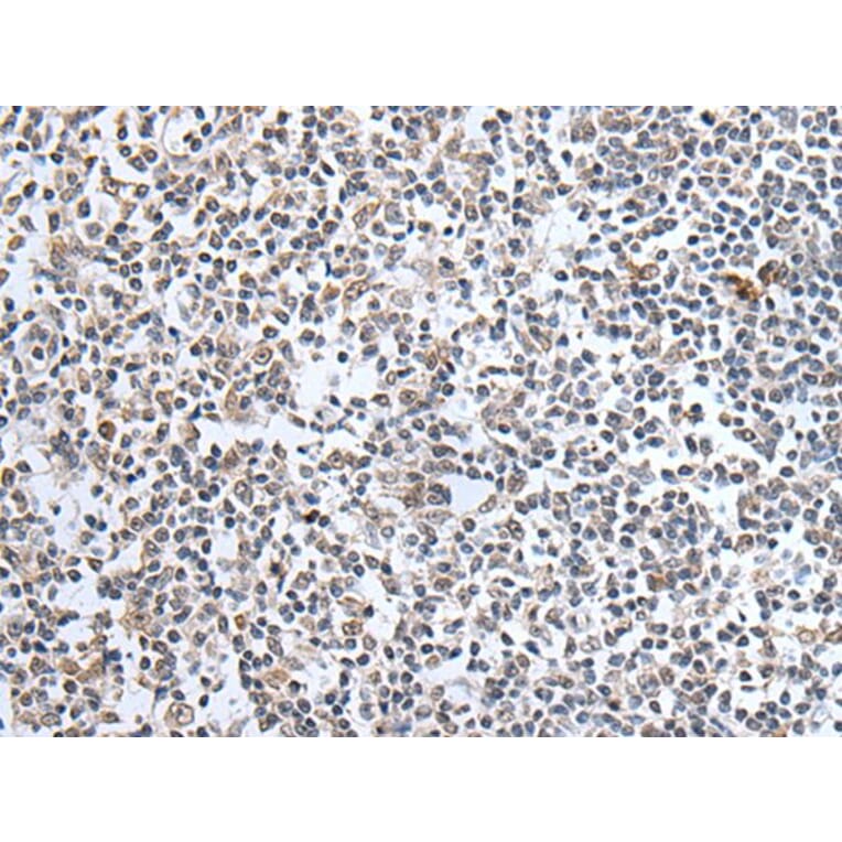 SULF2 Antibody from Signalway Antibody (43638) - Antibodies.com