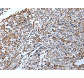 TRPC5 Antibody from Signalway Antibody (43643) - Antibodies.com