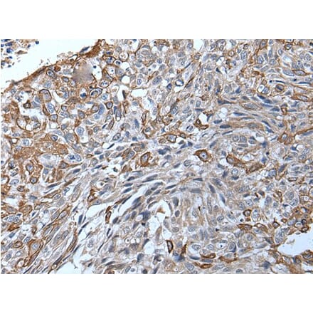 TRPC5 Antibody from Signalway Antibody (43643) - Antibodies.com