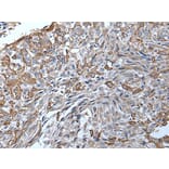TRPC5 Antibody from Signalway Antibody (43643) - Antibodies.com