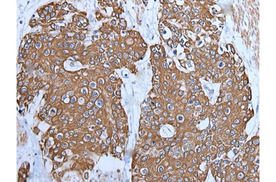 TRPC5 Antibody from Signalway Antibody (43643) - Antibodies.com