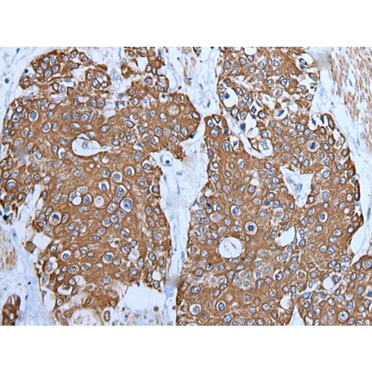 TRPC5 Antibody from Signalway Antibody (43643) - Antibodies.com