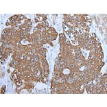 TRPC5 Antibody from Signalway Antibody (43643) - Antibodies.com