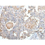 CLDN6 Antibody from Signalway Antibody (43653) - Antibodies.com