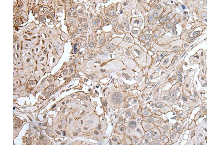 CLDN6 Antibody from Signalway Antibody (43653) - Antibodies.com