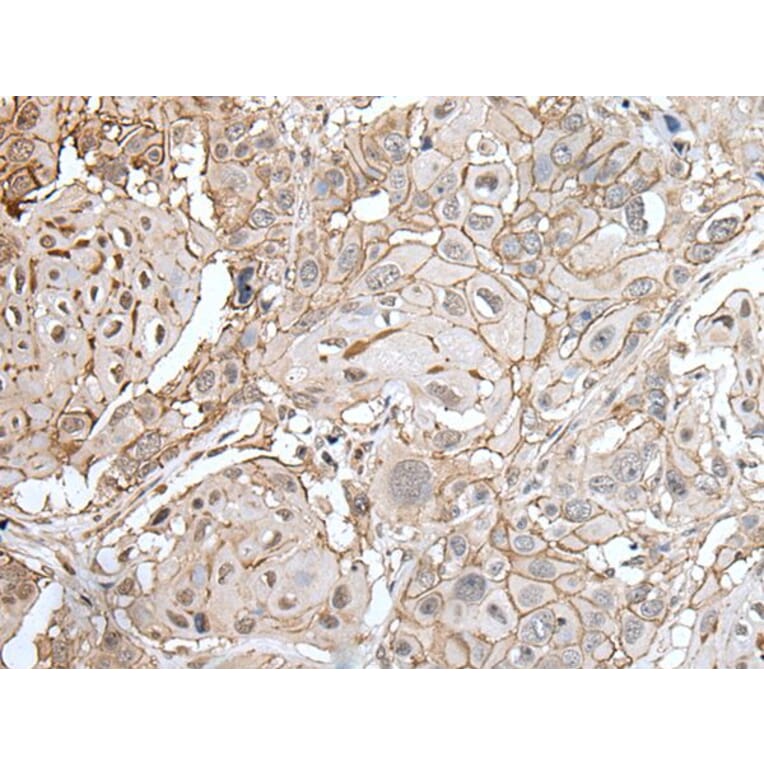 CLDN6 Antibody from Signalway Antibody (43653) - Antibodies.com