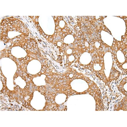 GANAB Antibody from Signalway Antibody (43659) - Antibodies.com