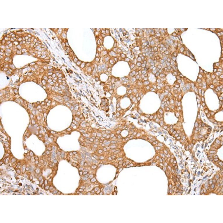 GANAB Antibody from Signalway Antibody (43659) - Antibodies.com