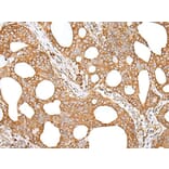 GANAB Antibody from Signalway Antibody (43659) - Antibodies.com