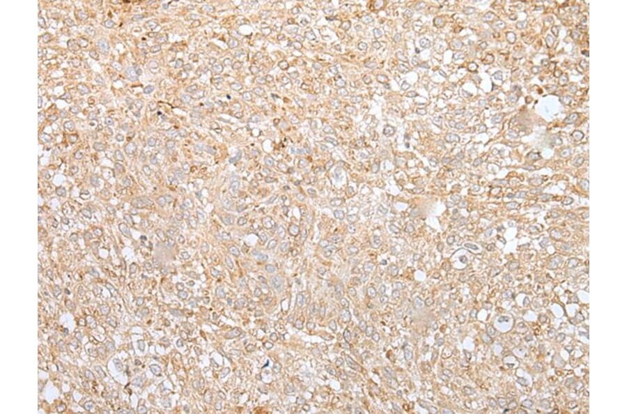 GANAB Antibody from Signalway Antibody (43659) - Antibodies.com