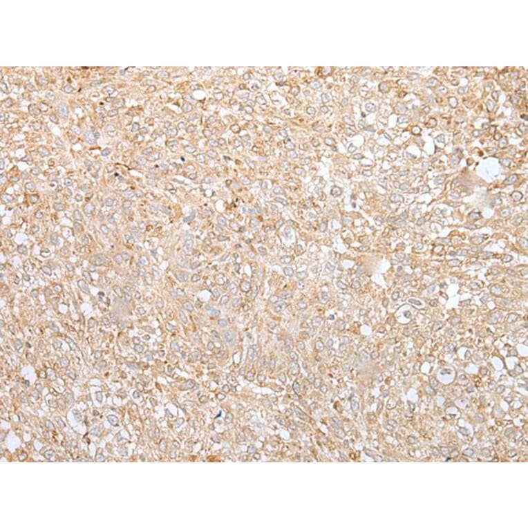 GANAB Antibody from Signalway Antibody (43659) - Antibodies.com