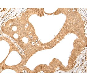 KMT2B Antibody from Signalway Antibody (43660) - Antibodies.com