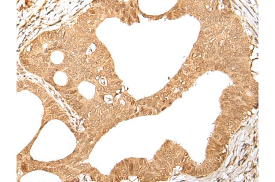 KMT2B Antibody from Signalway Antibody (43660) - Antibodies.com