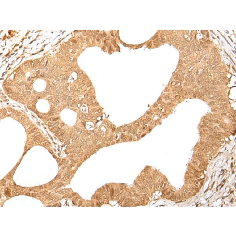 KMT2B Antibody from Signalway Antibody (43660) - Antibodies.com