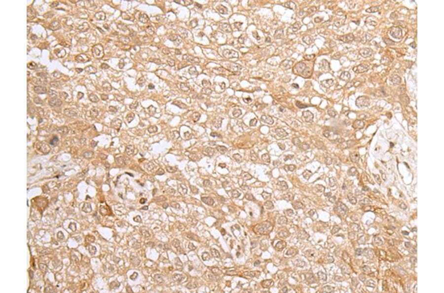 KMT2B Antibody from Signalway Antibody (43660) - Antibodies.com