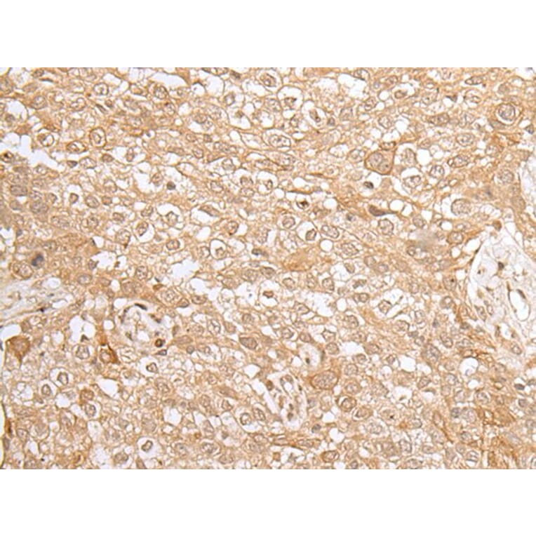 KMT2B Antibody from Signalway Antibody (43660) - Antibodies.com