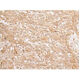 KMT2B Antibody from Signalway Antibody (43660) - Antibodies.com