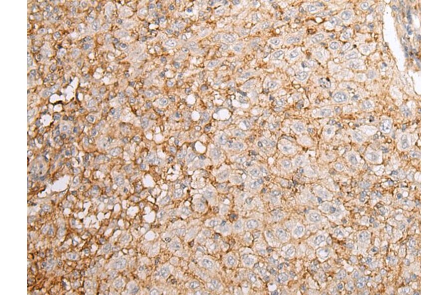 EFNA4 Antibody from Signalway Antibody (43668) - Antibodies.com