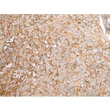 EFNA4 Antibody from Signalway Antibody (43668) - Antibodies.com